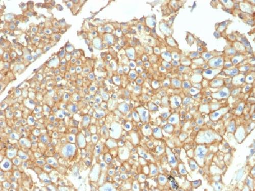 EPCAM Antibody