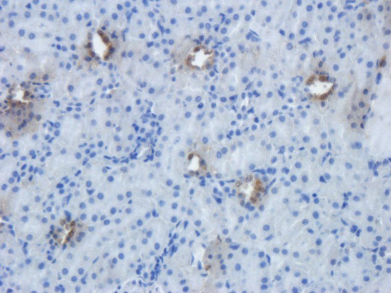 EpCAM antibody