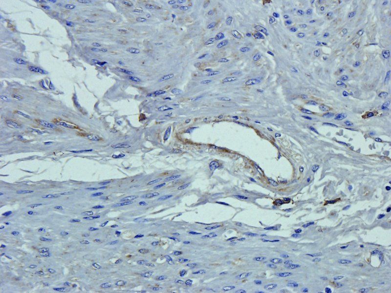 EpCAM Rabbit Polyclonal Antibody