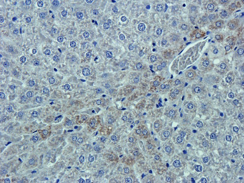 EpCAM Rabbit Polyclonal Antibody