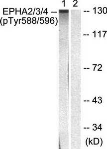 EPHA2/3 (Phospho-Tyr588/596) Antibody