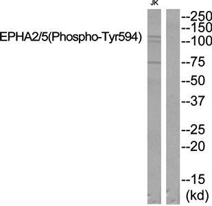 EPHA2/5 (Phospho-Tyr594) Antibody