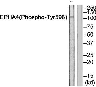 EPHA4 (Phospho-Tyr596) Antibody