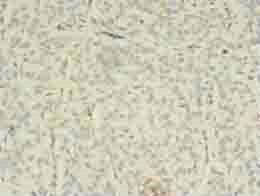 EPHA7 Antibody