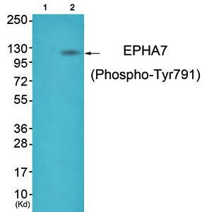 EPHA7 (Phospho-Tyr791) Antibody