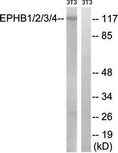 EPHB1/2/3/4 (Ab-600/602/614/596) Antibody