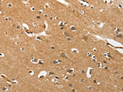 EPHB3 Antibody