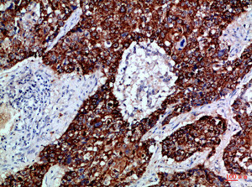 EPHB3 Antibody