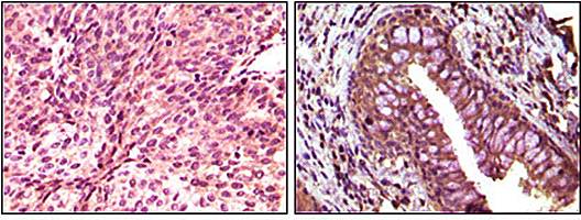 EphB6 Antibody
