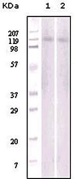 EphB6 Antibody