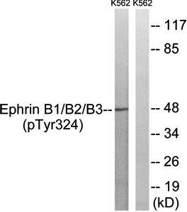 Ephrin B1/B2/B3 (Phospho-Tyr324) Antibody