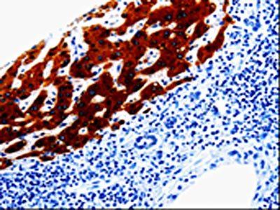 EPHX1 Antibody