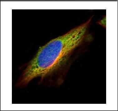 EPHX1 Rabbit Polyclonal Antibody
