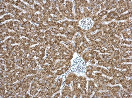 EPHX1 Rabbit Polyclonal Antibody