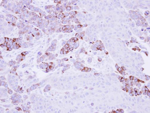 EPHX1 Rabbit Polyclonal Antibody