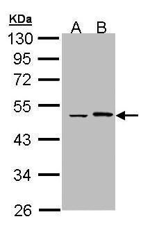 EPHX1 Rabbit Polyclonal Antibody
