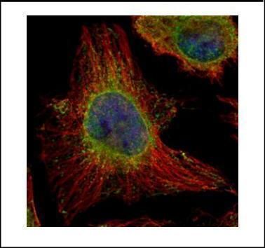 EPHX1 Rabbit Polyclonal Antibody
