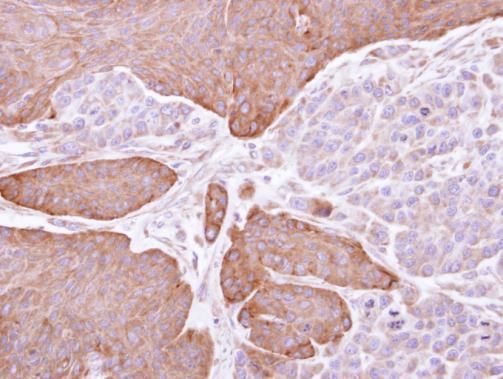 EPHX1 Rabbit Polyclonal Antibody