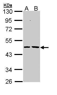 EPHX1 Rabbit Polyclonal Antibody