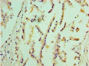 EPHX1 Antibody