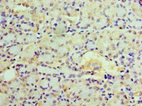 EPHX1 Antibody