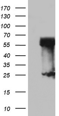 EPHX1 Antibody