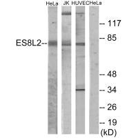 EPS8L2 Antibody