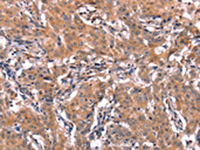 ERAS Antibody