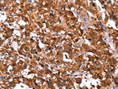 ERAS Antibody