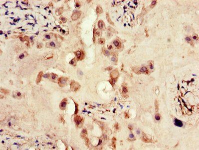 ERBB4 Antibody