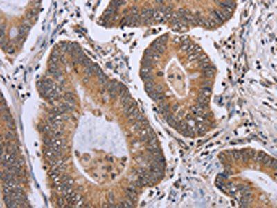 ERCC6L Antibody