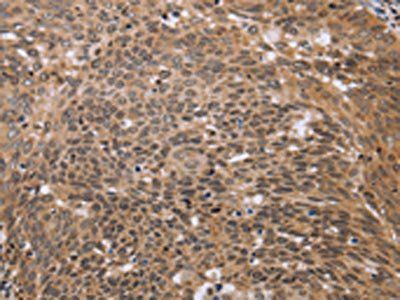 ERCC6L Antibody