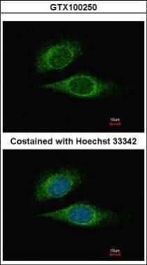 ESE1 antibody [C2C3], C-term