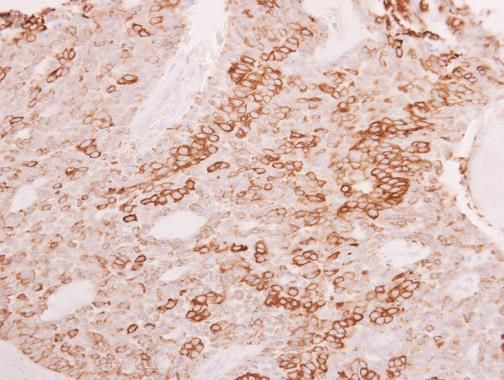 ESE1 antibody [C2C3], C-term