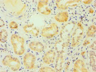 ESRRA Antibody