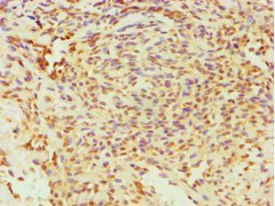 ESRRA Antibody