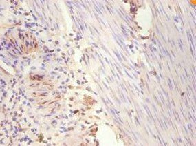ESR1 Antibody