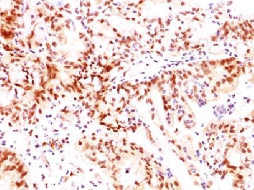 ESR2 Antibody