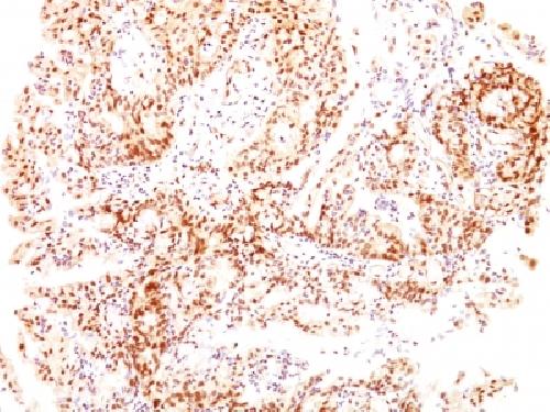 ESR2 Antibody