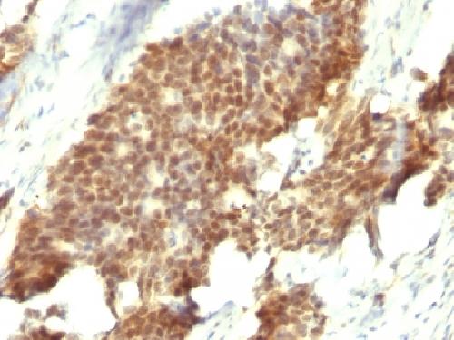 ESR2 Antibody