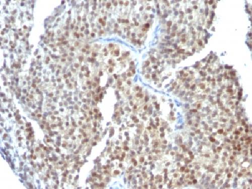 ESR2 Antibody