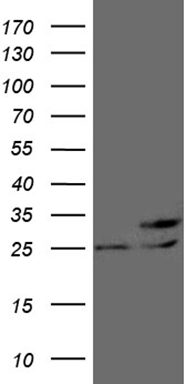 Estrogen Related Receptor alpha Antibody