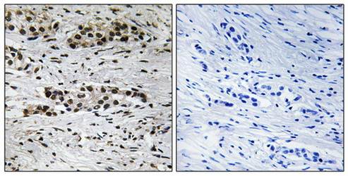 Estrogen Receptor-α (Phospho-Ser102) Antibody
