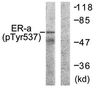 Estrogen Receptor-α (Phospho-Tyr537) Antibody
