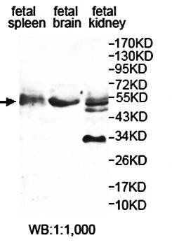 ETF1 Rabbit Polyclonal Antibody