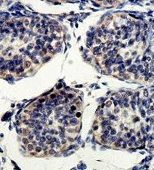 ETF1 Rabbit Polyclonal Antibody