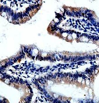 ETFDH Rabbit Polyclonal Antibody