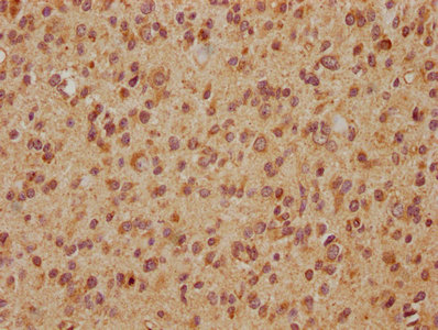 EXOC7 Antibody