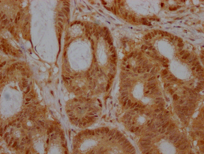 EZH2 Antibody