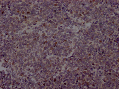 EZH2 Antibody